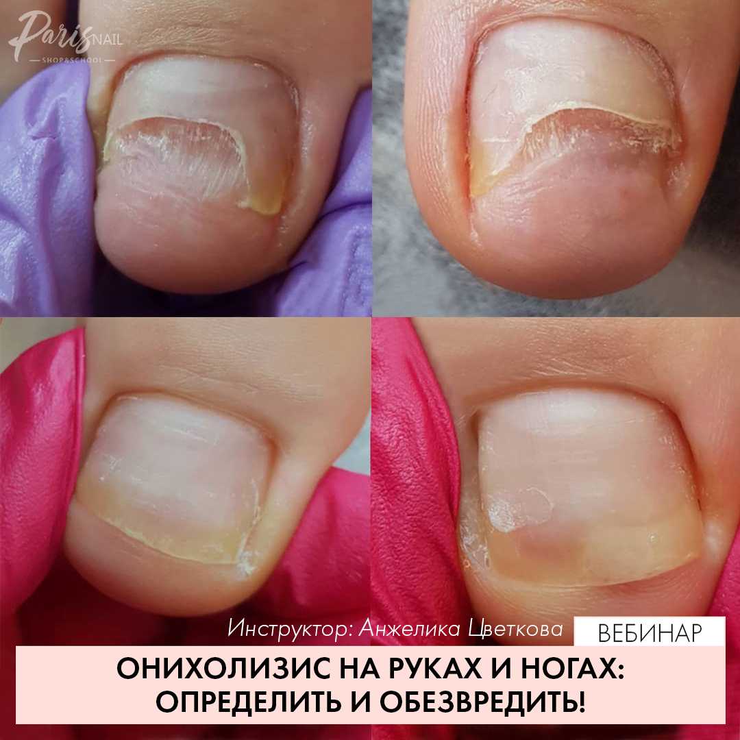 Печка не дует на стекло ваз 2107 – защита имущества