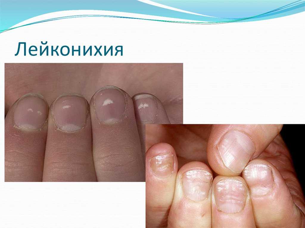 ✅ почему в ваз 2107 плохо греет печка - avtochehol.su
